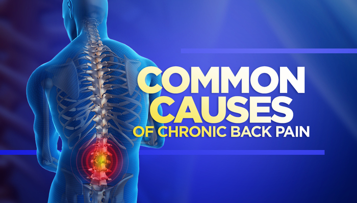 Common Causes of Chronic Back Pain | Dr. Kevin Darr - Top Orthopedic ...